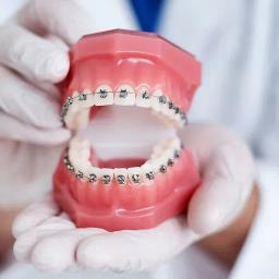 https://admin.realteethclinic.com/uploads/braces_a544f569ab.webp